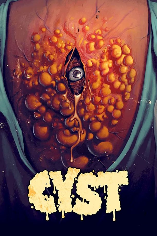 囊肿Cyst (2020)